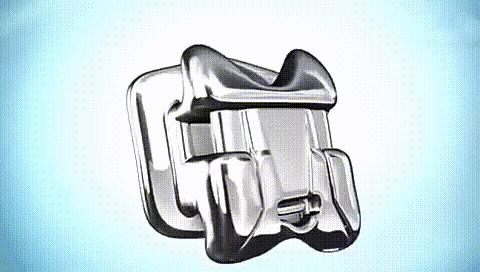 多个牙齿戴牙套矫正的全过程,部分牙齿牙套矫正的全过程