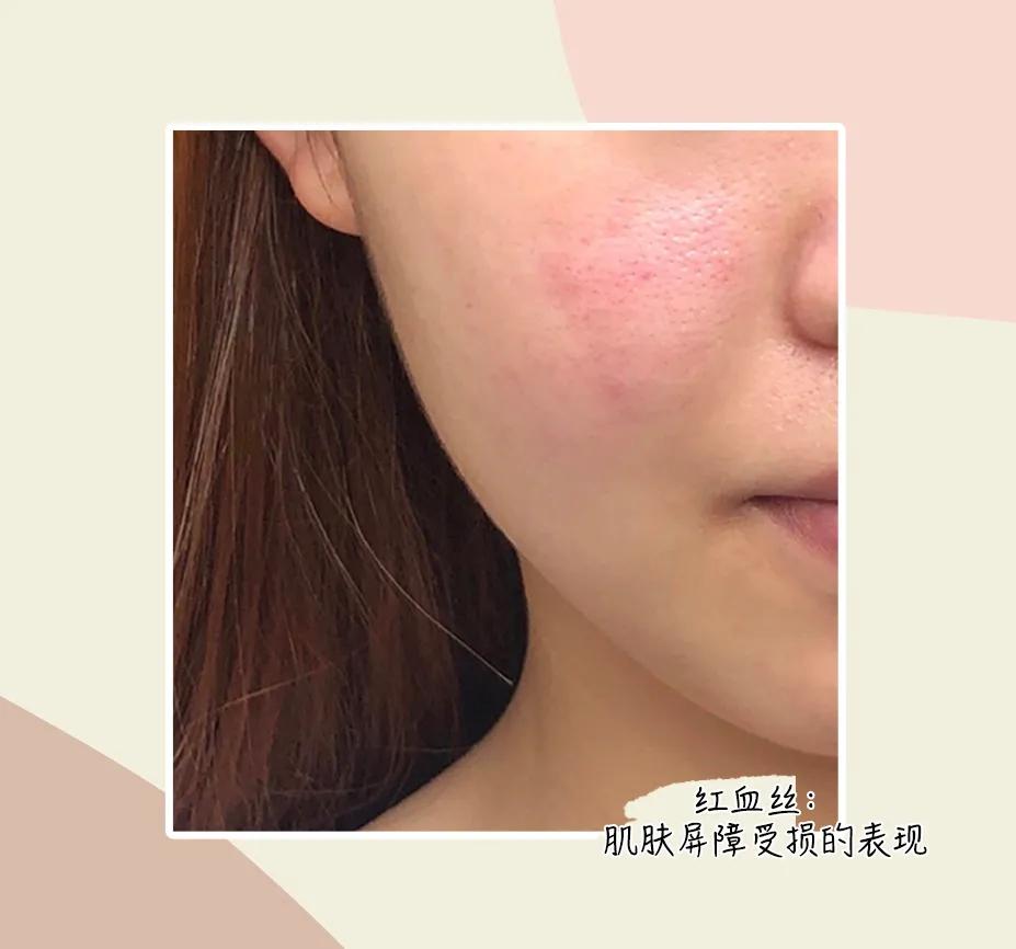 水乳买套装好还是分开买,水乳为什么要分开买