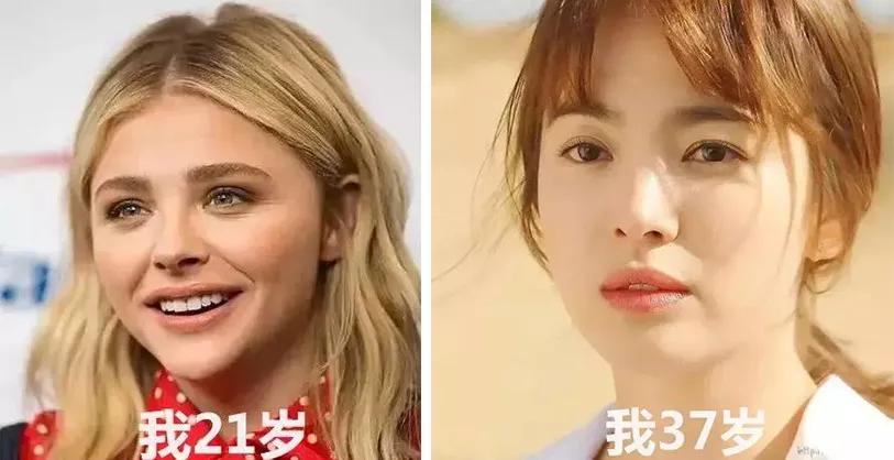 眼容易肿有黑眼圈,黑眼圈肿眼泡有什么小妙招