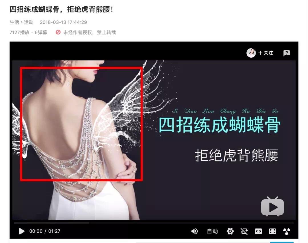 改善蝴蝶背的方法,天生的蝴蝶背能改善吗