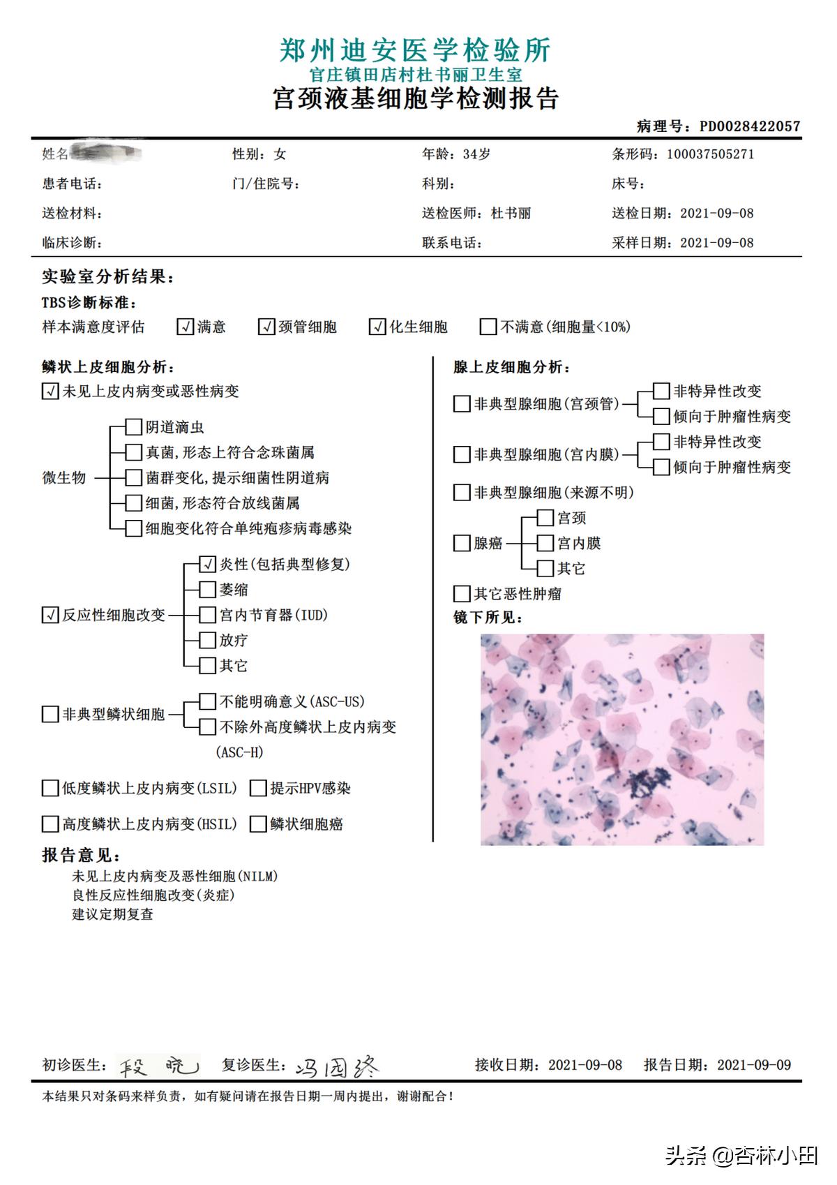 宫颈癌hpv疫苗打一针有抗体吗,hpv和tct检查多久内适合打hpv疫苗