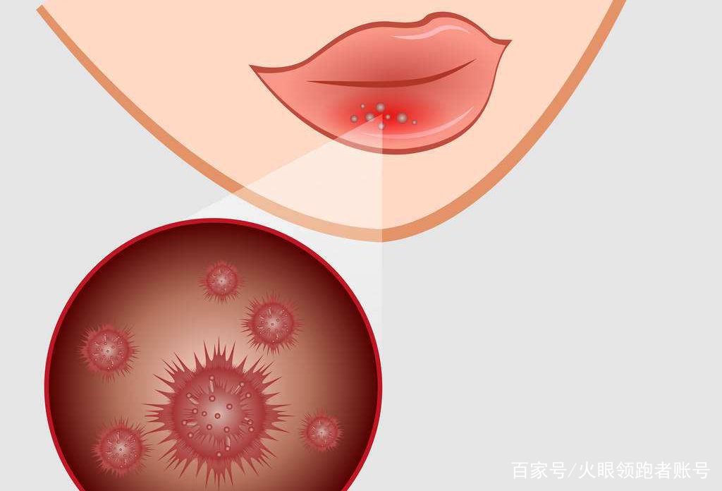 爱唇彩飞扬，但也别“吃坏了”身体！