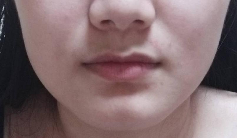 为什么有些人会长獠牙,为什么有的人成年了还会长牙