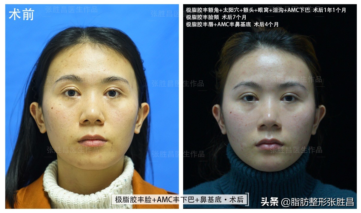 颧骨突出面相刻薄怎么办,脸型崎岖颧骨突出