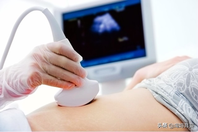 通过孕囊计算孕周,知道准确怀孕时间怎么判断预产期