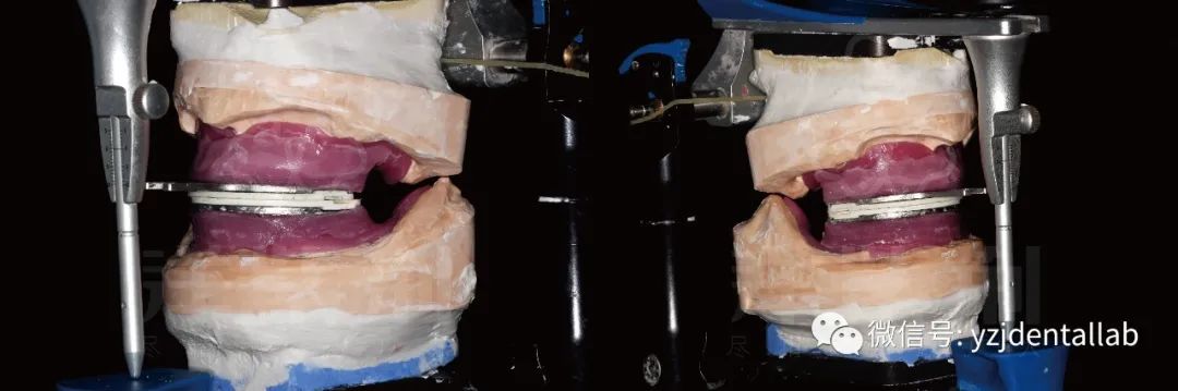 病例教学视频,病例分析操作技能