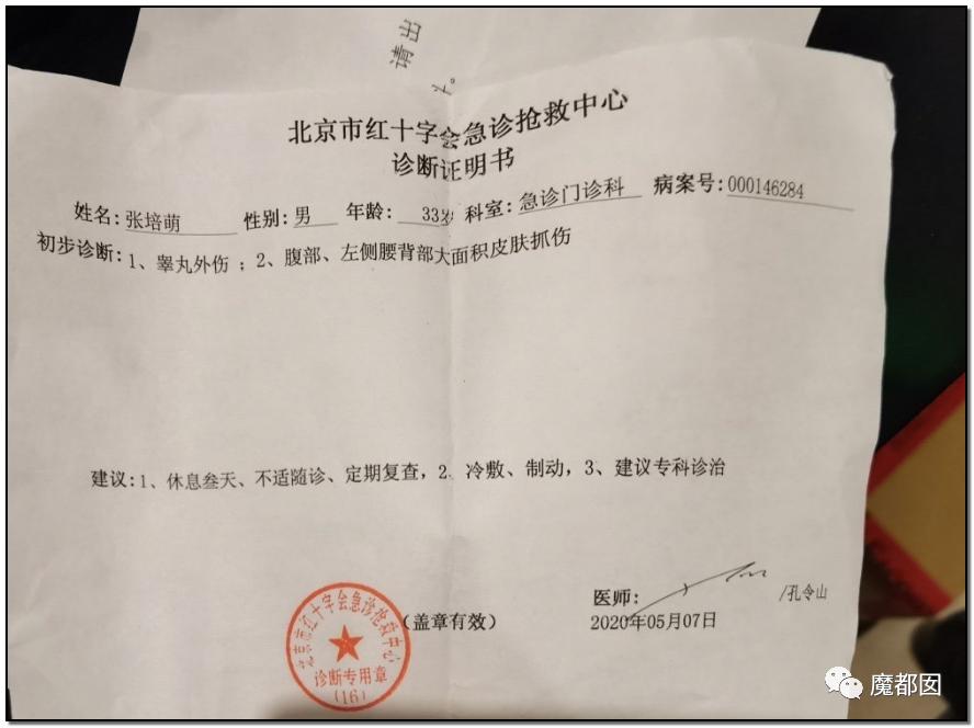 短跑名将张培萌被曝家暴,短跑名将张培萌殴打岳母被行拘