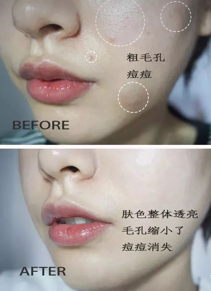 怎样敷水光面膜,明星每天敷面膜