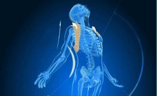 驼背怎么办最有效的方法,驼背怎么矫正最有效方法