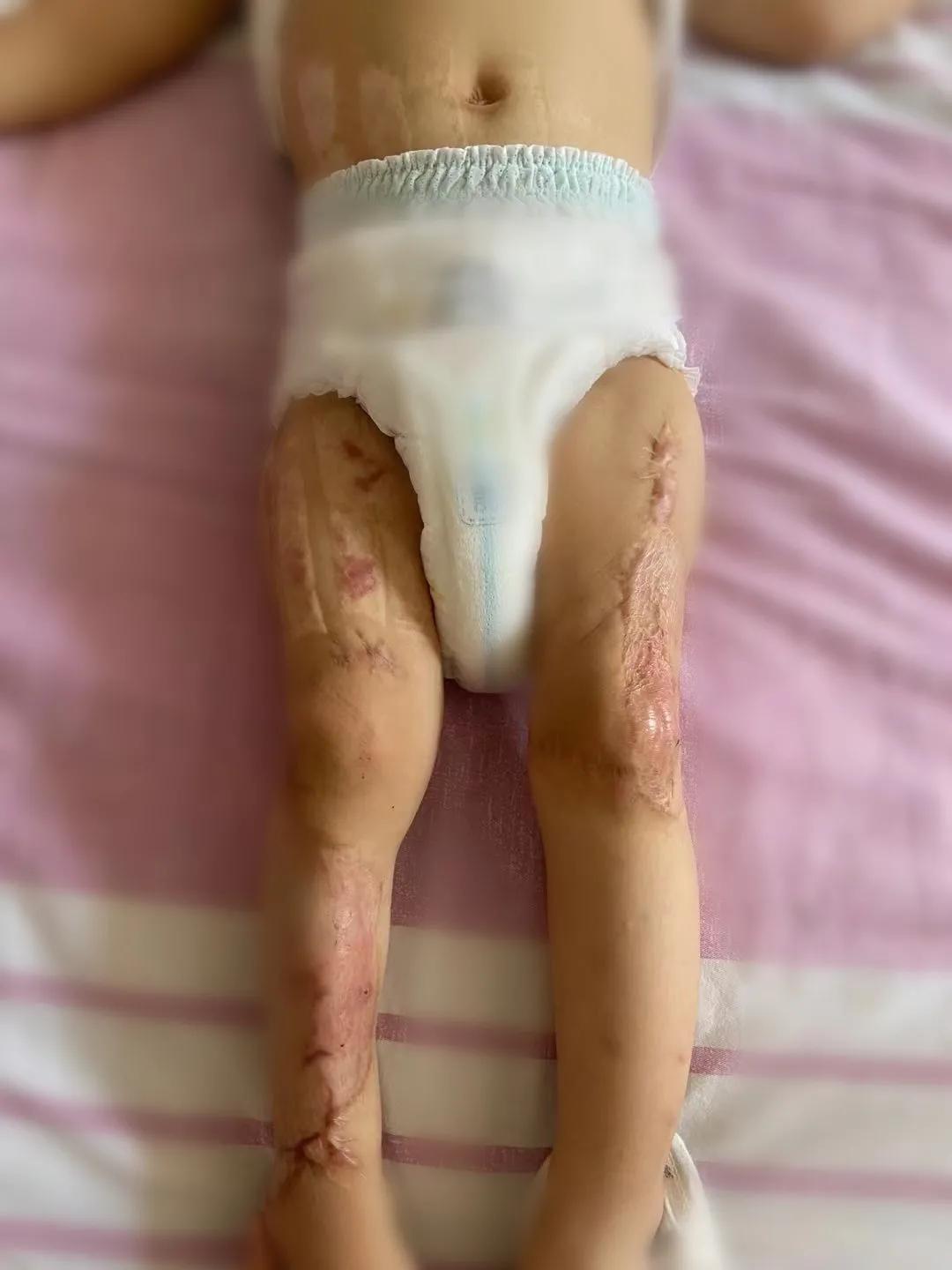 多科室医生联合抢救,多学科联合抢救病人