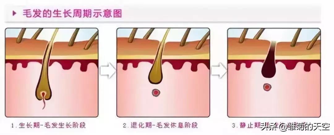 20岁脱发和45岁脱发的区别,听说90后第一批已经开始脱发了