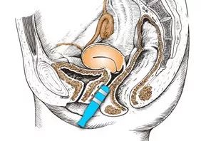 3.8产康店女神节活动方案,3.8女神节病房活动策划