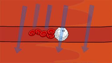 奥利司他排出油可以瘦吗,奥利司他可以排顽固脂肪吗