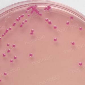 大肠埃希菌培养,大肠埃希菌70%正常吗