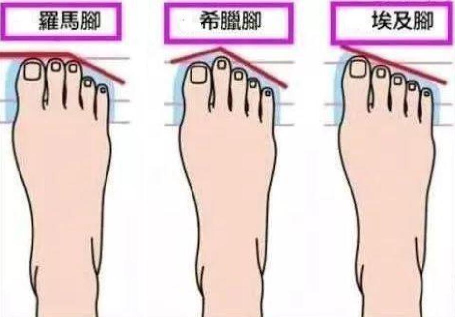 你的脚是正常脚型吗,你的脚型属于哪种呢