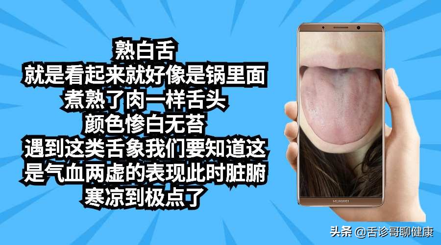 舌诊哥：遗精滑精、气短、虚汗、紧张、焦虑等舌象分析