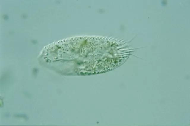 收藏!24种污水处理微生物菌相及指导意义,环保人必看(多图)