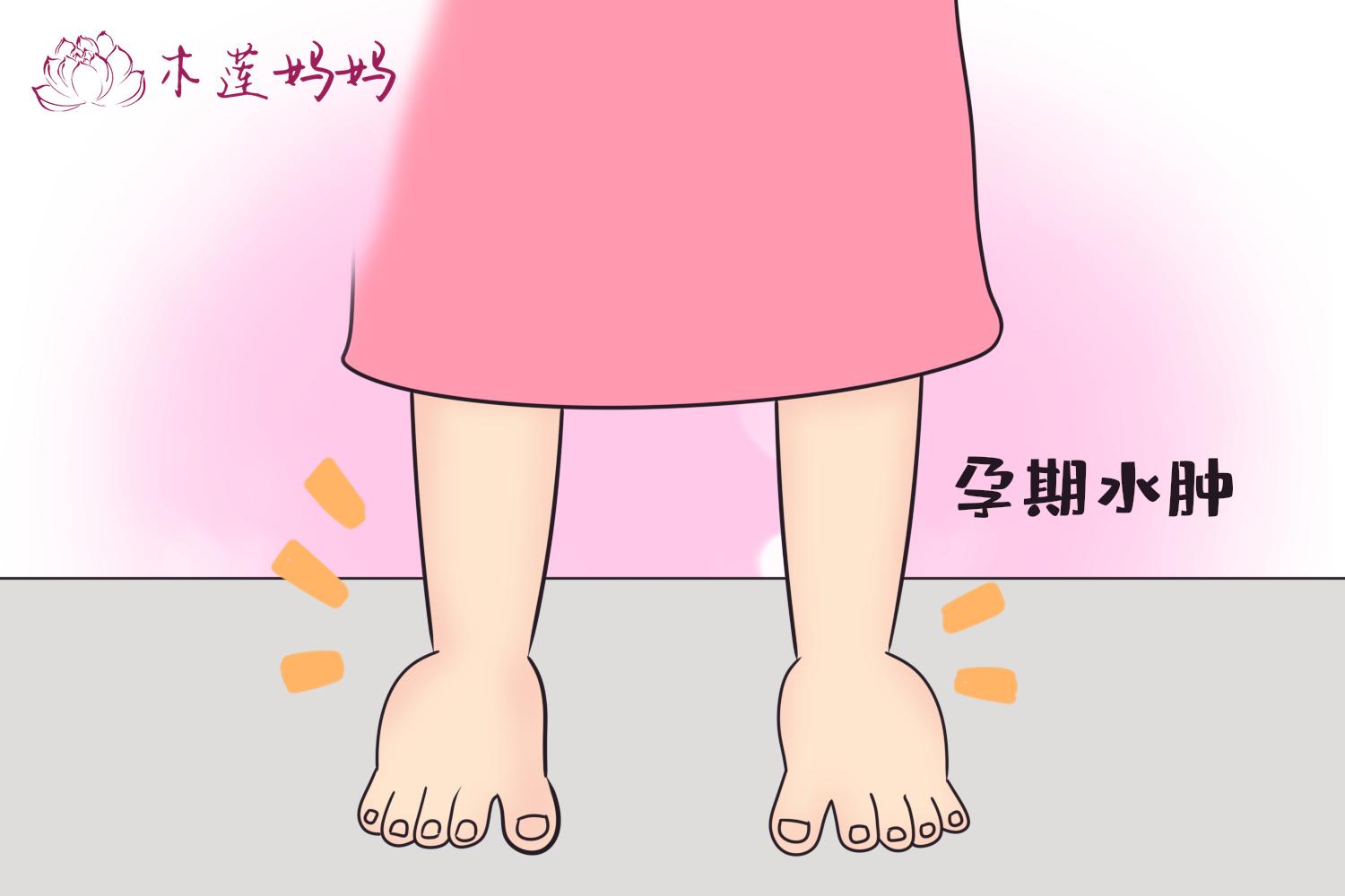 孕期浮肿并不是“喝水多”，和这些原因有直接关系，吃动两种缓解