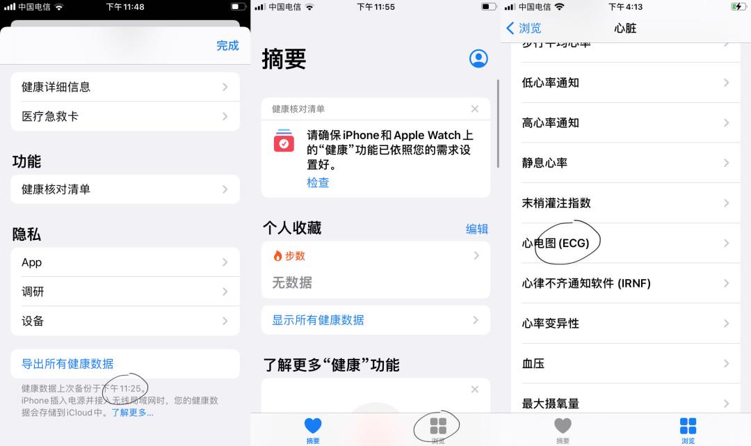 applewatch测ecg心电图,applewatch如何激活ecg