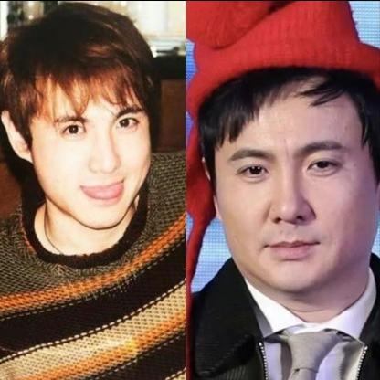 脸部发腮怎么改善,改善发腮的动作真的有效吗