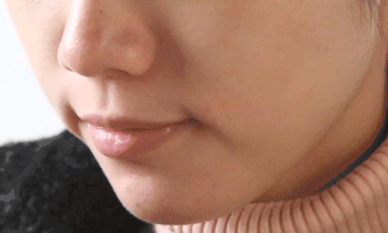 马应龙去除眼纹,马应龙去细纹