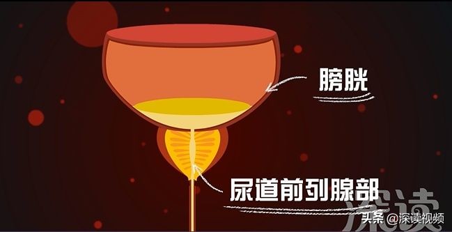 尿不爽,尿不臭是怎么回事