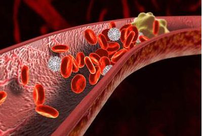 髌骨脱位症怎么治,一篇文章了解髌骨脱位及相关治疗