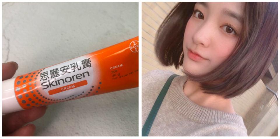 女明星专用祛痘膏,女明星祛痘药膏