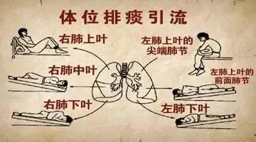 预防疫情健康宣教视频,疫情期间如何防治血管疾病