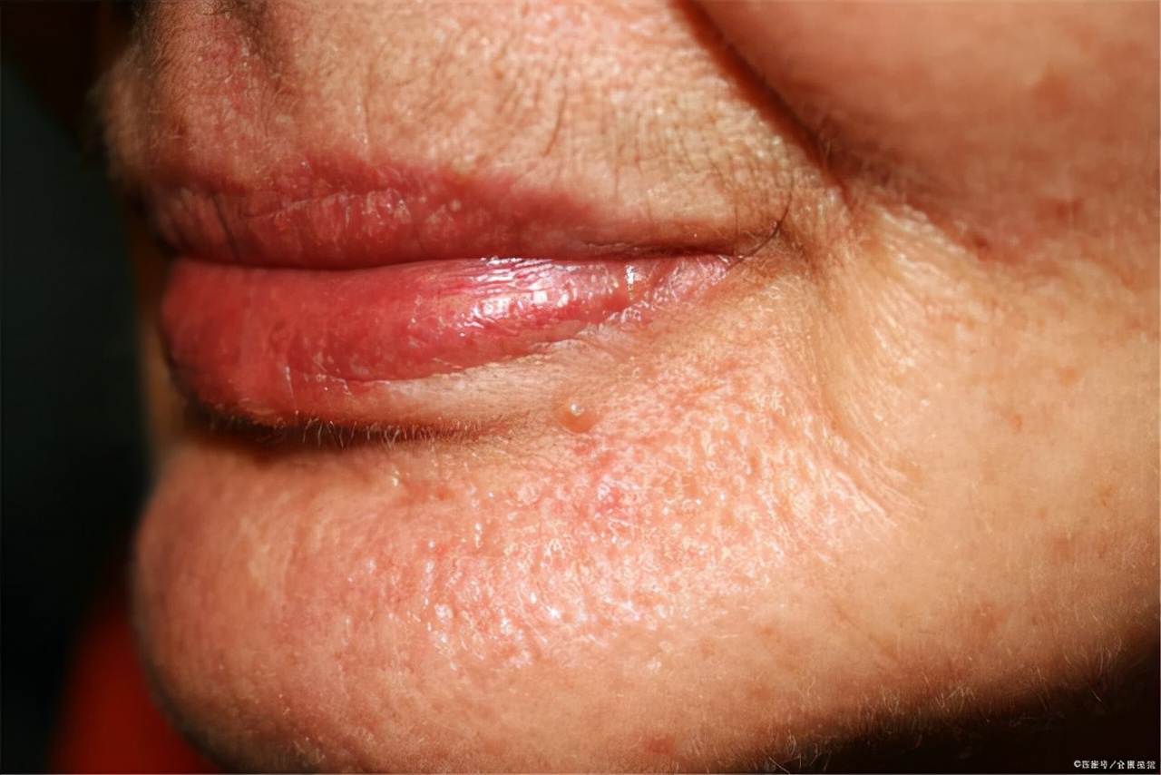 女性雌激素偏低，身体会有哪些表现？但愿你一个都不占