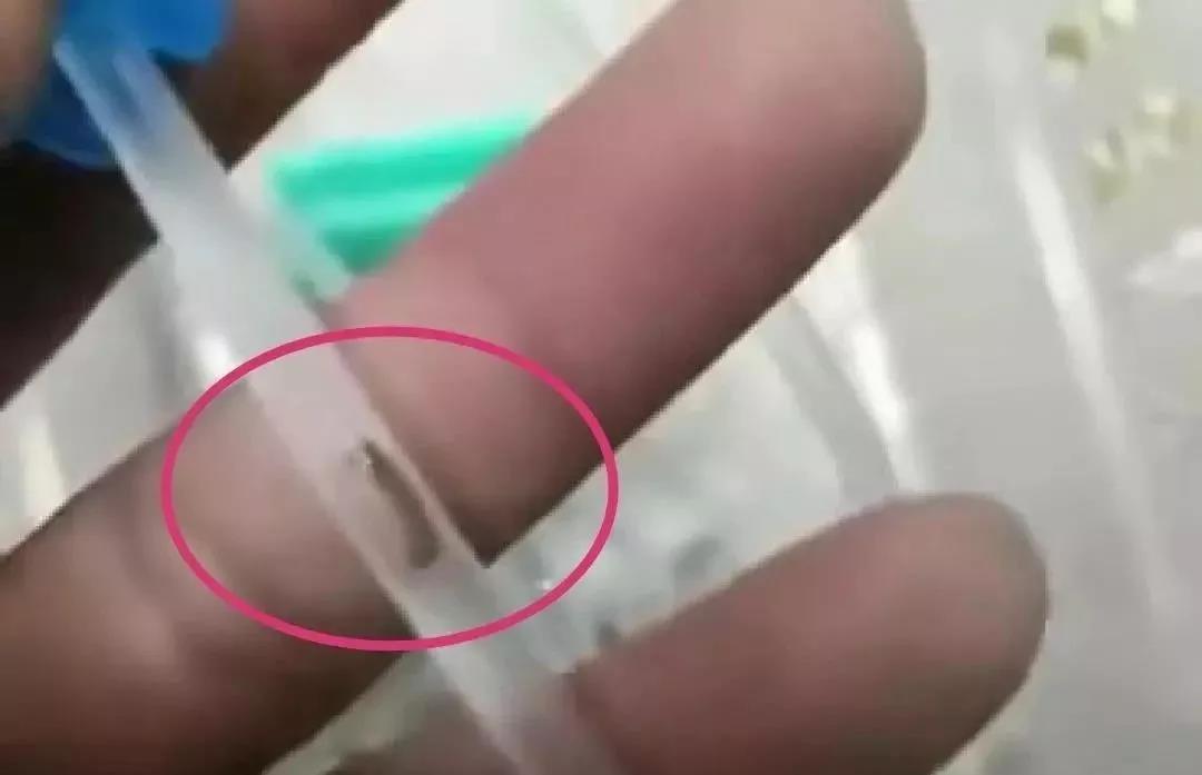 小孩输液管里有虫状物,孩子输液管有虫子后续