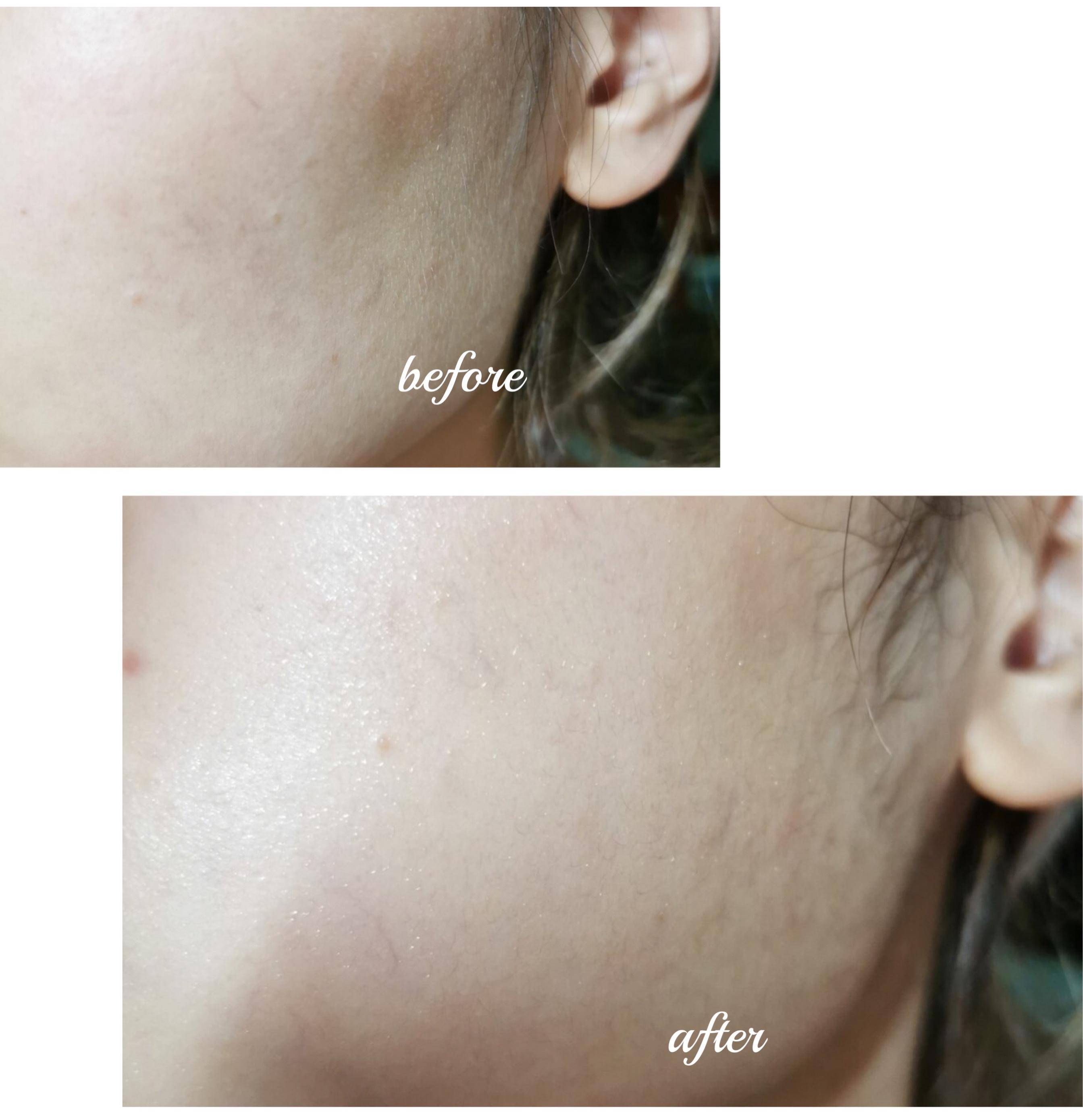 面容焦虑如何安慰,容貌焦虑