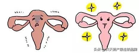 出现这12个症状，说明你子宫有问题