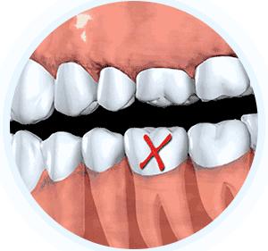 德州口腔医院网上预约种牙,德州种牙的口腔医院哪家好