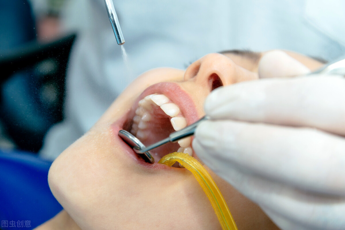 口臭问题洗牙能得到缓解吗,口臭可以通过洗牙解决吗