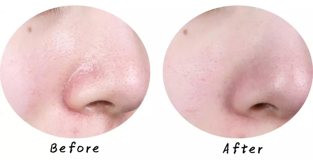 swisse麦卢卡蜂蜜排毒清洁面膜,超温和清洁面膜推荐哪个