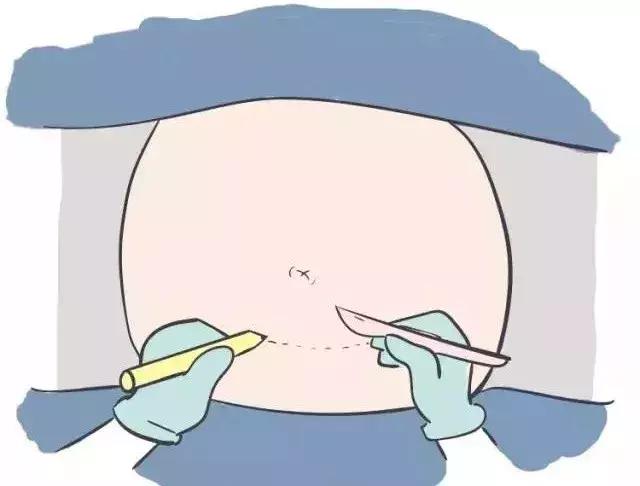 世上最丑的“微笑”……你不喜欢拥有它,但它的伟大无可否认!