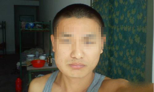 长期吃槟榔的人有哪些表现,长期吃槟榔的人牙齿是怎么样的