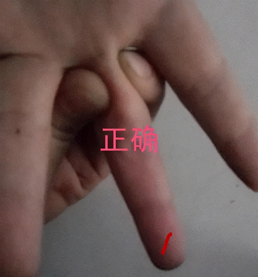 手指肚破了一直流血,手指肚裂小口怎么治