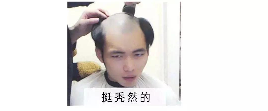 每天掉100根头发多久秃头,每天掉200根头发多久会秃头