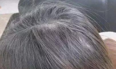 洗了头发第二天头就很油很痒,洗了头发第二天就臭了什么原因