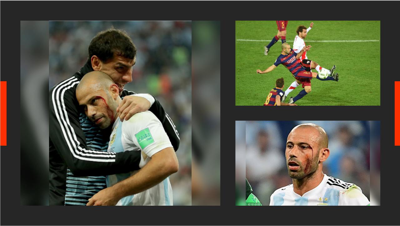 普约尔和马斯切拉诺,马斯切拉诺普约尔