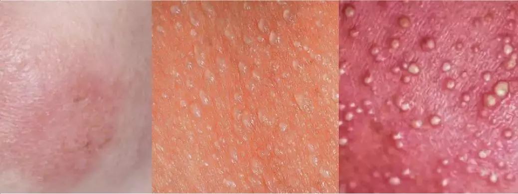 阜新阳光大姐近况,阜新阳光大姐