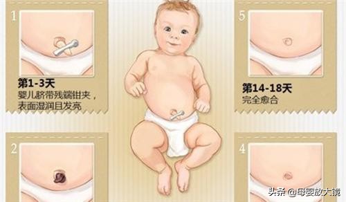 如何预防宝宝进幼儿园传染生病,新生儿宝宝如何护理常识