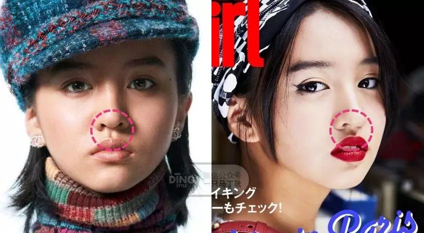 戴牙套凸嘴怎么化妆,凸嘴整牙削骨吗