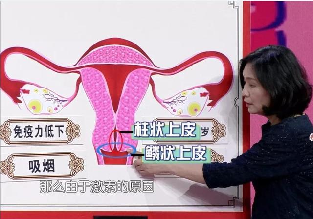 宫颈癌早期10种症状灸哪些穴位,如果得了宫颈癌是啥症状