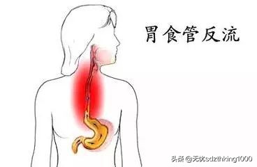 总是反酸烧心要注意什么,老是在半夜反酸烧心是怎么回事
