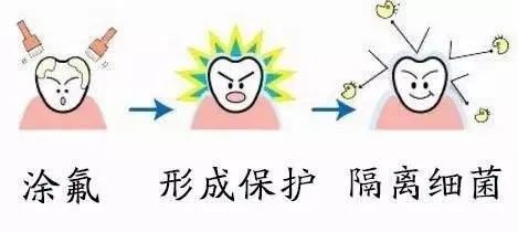 涂氟还是窝沟封闭,涂氟窝沟封闭有必要做吗