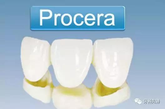 全瓷牙和烤瓷牙到底哪个好,烤瓷牙和全瓷牙优缺点及价格