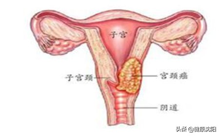 健康科普小课堂老年栏目,健康科普小讲堂短视频